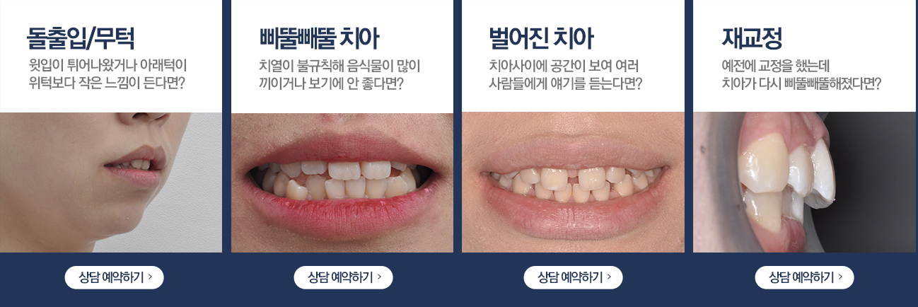 가임기