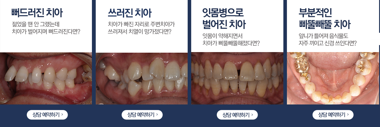 중년기